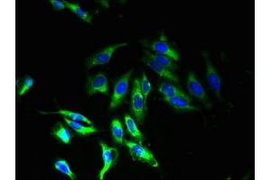 Immunofluorescent analysis of Hela cells using ABIN7173203 at dilution of 1:100 and Alexa Fluor 488-congugated AffiniPure Goat Anti-Rabbit IgG(H+L) (TMEM33 antibody  (AA 177-247))