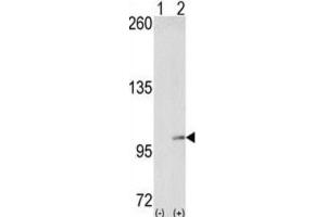Western Blotting (WB) image for anti-EPH Receptor A4 (EPHA4) antibody (ABIN3003330)