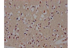 Immunohistochemistry of paraffin-embedded human brain tissue using ABIN7145172 at dilution of 1:300 (BCL11B antibody  (AA 500-550))