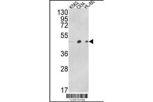 Western blot analysis of ACTR3B Antibody in K562, CEM, HL-60 cell line lysates (35ug/lane) (ACTR3B antibody  (C-Term))