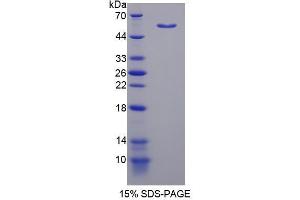 Image no. 1 for Nuclear Factor I/B (NFIB) (AA 1-233) protein (His tag,GST tag) (ABIN4990454) (NFIB Protein (AA 1-233) (His tag,GST tag))