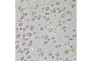 Immunohistochemistry of paraffin-embedded rat brain using EIF4A2 antibody. (EIF4A2 antibody  (AA 1-270))