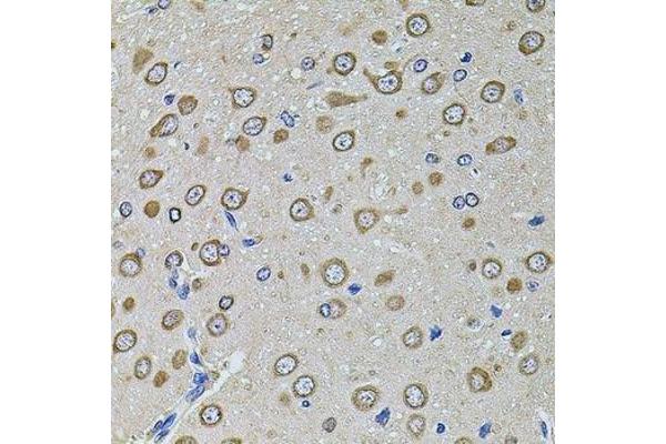 EIF4A2 antibody  (AA 1-270)