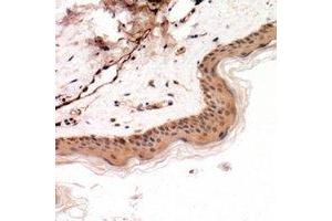 Immunohistochemical analysis of Cytokeratin 14/17 staining in human skin formalin fixed paraffin embedded tissue section. (Cytokeratin 14/17 antibody)