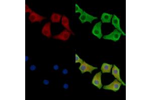 ABIN7096827 and ABIN7100893 staining Hela cells by IF/ICC.