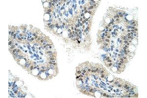 NOL6 antibody was used for immunohistochemistry at a concentration of 16. (Nucleolar Protein 6 antibody)