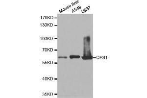 Western blot analysis of extracts of various cell lines, using CES1 antibody. (CES1 antibody)