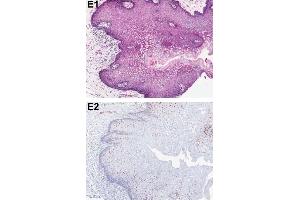 Immunohistochemistry (IHC) image for anti-Programmed Cell Death 4 (PDCD4) (pSer457) antibody (ABIN129708)