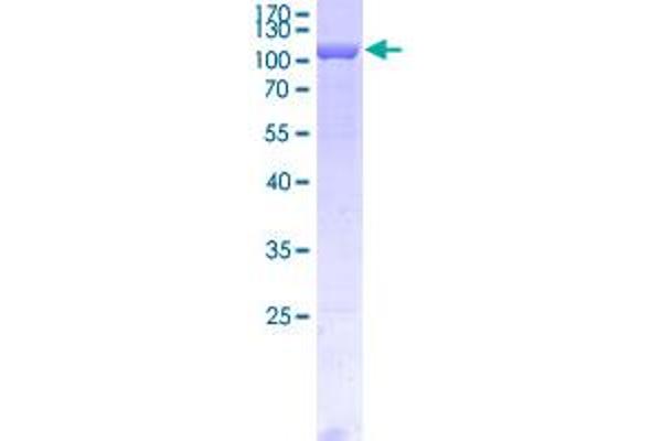 Fascin Protein (FSCN1) (AA 1-493) (GST tag)