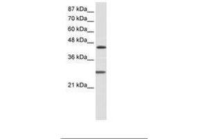 Image no. 2 for anti-Hairy and Enhancer of Split 6 (HES6) (C-Term) antibody (ABIN202083)