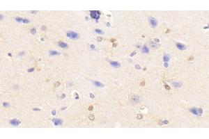 Immunohistochemistry (IHC) image for anti-Tumor Necrosis Factor alpha (TNF alpha) (AA 80-235) antibody (APC) (ABIN7437071)