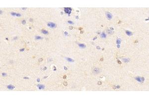 Detection of TNFa in Rabbit Cerebrum Tissue using Polyclonal Antibody to Tumor Necrosis Factor Alpha (TNFa) (TNF alpha antibody  (AA 80-235))