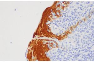 Immunohistochemistry of paraffin-embedded Human tonsil using S100A7 Polycloanl Antibody at dilution of 1:200