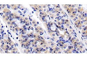 Detection of RPS6Kb1 in Porcine Stomach Tissue using Polyclonal Antibody to Ribosomal Protein S6 Kinase Beta 1 (RPS6Kb1) (RPS6KB1 antibody  (AA 91-352))
