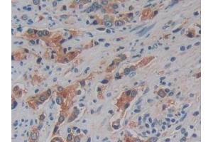 Immunohistochemistry (IHC) image for anti-Kallikrein 10 (KLK10) (AA 35-276) antibody (ABIN7429862)