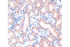 Used in DAB staining on fromalin fixed paraffin- embedded kidney tissue (TRAPPC10 antibody  (AA 1077-1259))