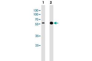 Western blot analysis of Lane 1: A431 cell line lysates Lane 2: mouse brain tissue lysates reacted with PINK1 monoclonal antibody  at 1:1000 dilution. (PINK1 antibody)