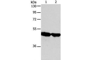 Western Blot analysis of Human fetal liver and liver cancer tissue using AADAC Polyclonal Antibody at dilution of 1:600 (AADAC antibody)