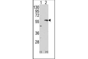 Image no. 1 for anti-Matrix Metallopeptidase 13 (Collagenase 3) (MMP13) (C-Term) antibody (ABIN358686) (MMP13 antibody  (C-Term))