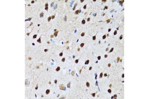 Immunohistochemistry of paraffin-embedded rat brain using CCAR2 antibody (ABIN5974285) at dilution of 1/100 (40x lens). (CCAR2 antibody)