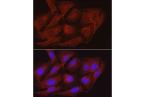Immunofluorescence analysis of U2OS cells using PPP1R12A Rabbit pAb (ABIN6128260, ABIN6146059, ABIN6146061 and ABIN6213896) at dilution of 1:100 (40x lens). (PPP1R12A antibody  (AA 1-200))
