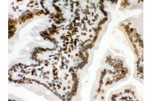 Immunohistochemistry (IHC) image for anti-Lamin B1 (LMNB1) (AA 266-583) antibody (ABIN3042505)