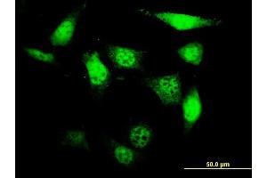 Immunofluorescence of monoclonal antibody to UCKL1 on NIH/3T3 cell. (UCKL1 antibody  (AA 301-400))