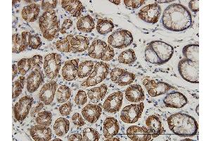 Immunoperoxidase of monoclonal antibody to AHCYL1 on formalin-fixed paraffin-embedded human stomach. (AHCYL1 antibody  (AA 1-101))