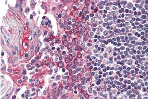 ABIN238540 (5µg/ml) staining of paraffin embedded Human Tonsil. (CK1 epsilon antibody  (C-Term))