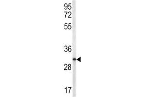 Western Blotting (WB) image for anti-CD40 Ligand (CD40LG) (AA 33-62) antibody (ABIN3028551)