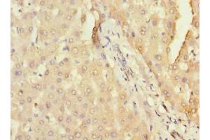 Immunohistochemistry of paraffin-embedded human liver tissue using ABIN7166660 at dilution of 1:100 (DHX3 (AA 694-1000) antibody)