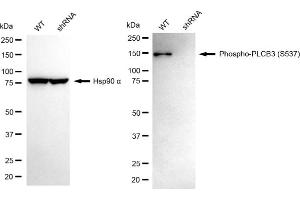 Western blotting analysis using phospho-PLCB3 (S537) antibody (ABIN7799822).