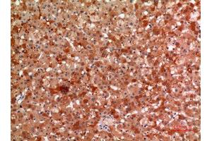 Immunohistochemistry (IHC) analysis of paraffin-embedded Human Liver, antibody was diluted at 1:100. (alpha 2 Macroglobulin antibody  (Internal Region))