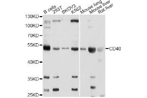 Western blot analysis of extracts of various cell lines, using CD40 Antibody. (CD40 antibody)