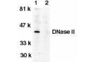 Western Blotting (WB) image for anti-Deoxyribonuclease II, Lysosomal (DNASE2) (C-Term) antibody (ABIN2473351) (DNASE2 antibody  (C-Term))