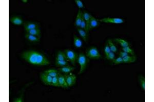 Immunofluorescent analysis of Hela cells using ABIN7152706 at dilution of 1:100 and Alexa Fluor 488-congugated AffiniPure Goat Anti-Rabbit IgG(H+L) (FERMT3 antibody  (AA 388-503))