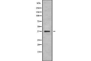 NEUROD4 antibody  (N-Term)