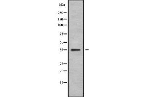 Western blot analysis NEUROD4 using COLO205 whole cell lysates