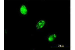 Immunofluorescence of monoclonal antibody to RBAF600 on HeLa cell. (UBR4 antibody  (AA 94-190))