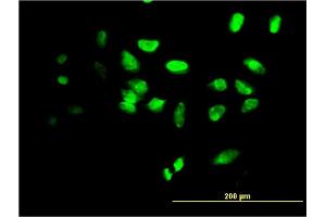 Immunofluorescence of monoclonal antibody to FOXF2 on HeLa cell. (FOXF2 antibody  (AA 346-443))