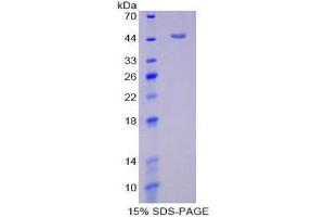 SDS-PAGE (SDS) image for Plasminogen Activator Inhibitor 1 (SERPINE1) (AA 24-402) protein (His tag) (ABIN1980754) (PAI1 Protein (AA 24-402) (His tag))