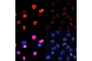 Immunofluorescence (IF) image for anti-Histone H2B (acLys5) antibody (ABIN7267733)