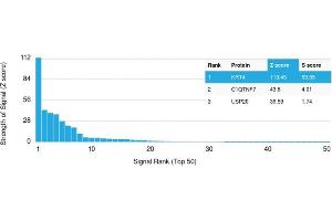 Analysis of Protein Array containing more than 19,000 full-length human proteins using Cytokeratin 4 Mouse Monoclonal Antibody (KRT4/2804). (KRT4 antibody  (AA 181-292))