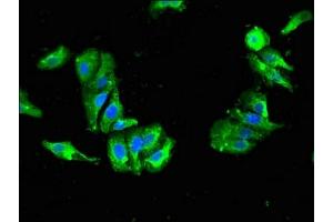 Immunofluorescent analysis of HepG2 cells using ABIN7144627 at dilution of 1:100 and Alexa Fluor 488-congugated AffiniPure Goat Anti-Rabbit IgG(H+L) (DDC antibody  (AA 24-215))