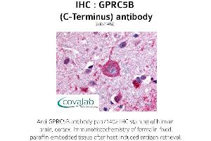 Image no. 1 for anti-G Protein-Coupled Receptor, Family C, Group 5, Member B (GPRC5B) (C-Term) antibody (ABIN1735212) (GPRC5B antibody  (C-Term))