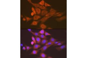 Immunofluorescence analysis of NIH-3T3 cells using SKP1 Rabbit mAb (ABIN7270120) at dilution of 1:100 (40x lens). (SKP1 antibody)