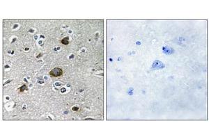 Immunohistochemistry analysis of paraffin-embedded human brain tissue using AKAP1 antibody. (AKAP1 antibody  (Internal Region))