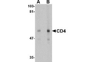 Western Blotting (WB) image for anti-CD4 (CD4) antibody (ABIN1031727) (CD4 antibody)