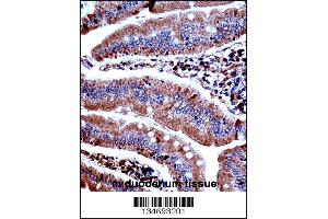 Mouse Prkd3 Antibody immunohistochemistry analysis in formalin fixed and paraffin embedded mouse duodenum tissue followed by peroxidase conjugation of the secondary antibody and DAB staining. (PRKD3 antibody  (N-Term))