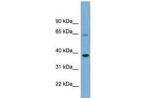 SNX7 antibody used at 1 ug/ml to detect target protein.